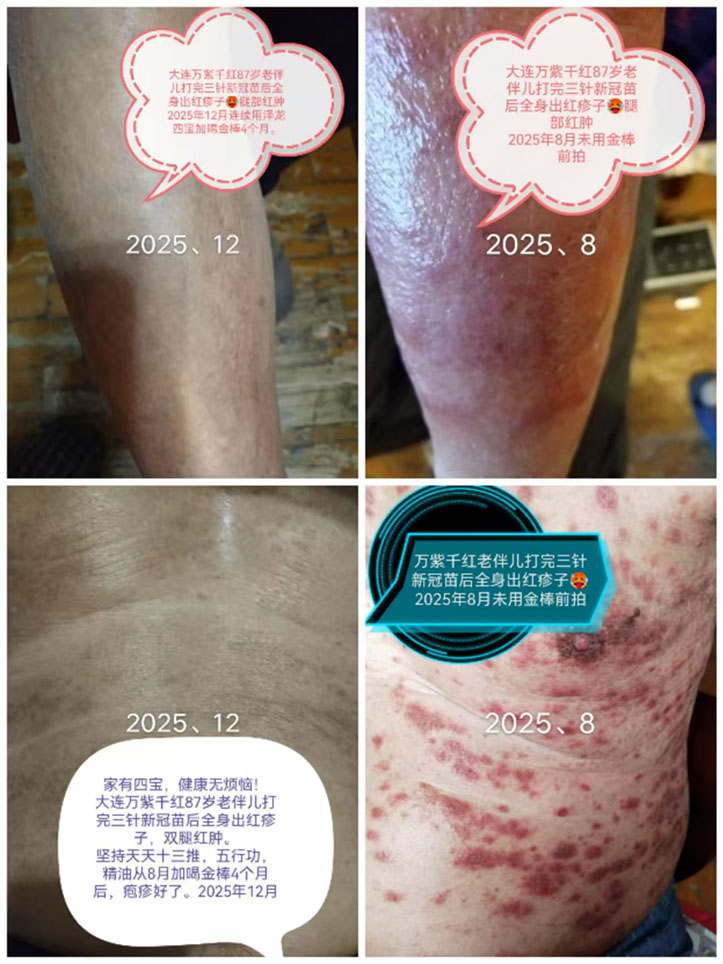 万紫千红分享泽龙院长“健康四宝”